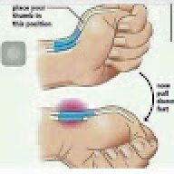 qALCAPONEp
